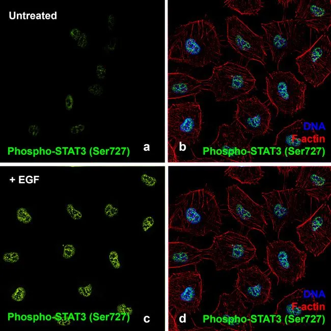 EGF Recombinant Human Protein